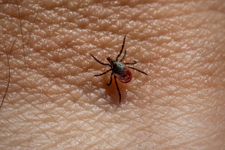 En fästing på huden symboliserar neuroborrelios